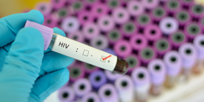 Curso Gratuito Curso en Investigación del VIH: Gestión de Proyectos